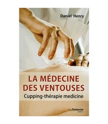 La médecine des ventouses