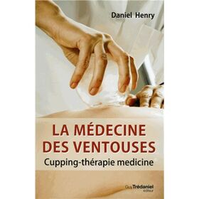 La médecine des ventouses