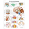 Planche anatomique Le cerveau humain